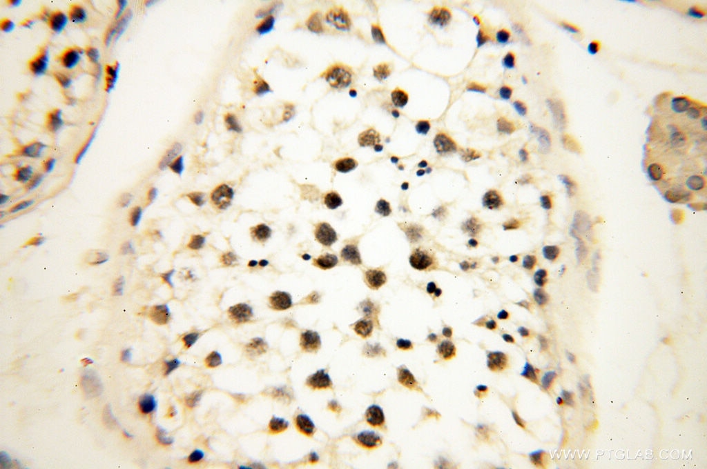 Immunohistochemistry (IHC) staining of human testis tissue using JUNB Polyclonal antibody (10486-1-AP)