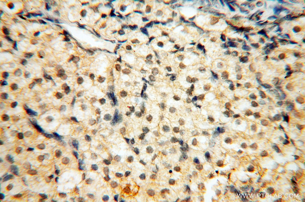 Immunohistochemistry (IHC) staining of human ovary tissue using JUNB Polyclonal antibody (10486-1-AP)