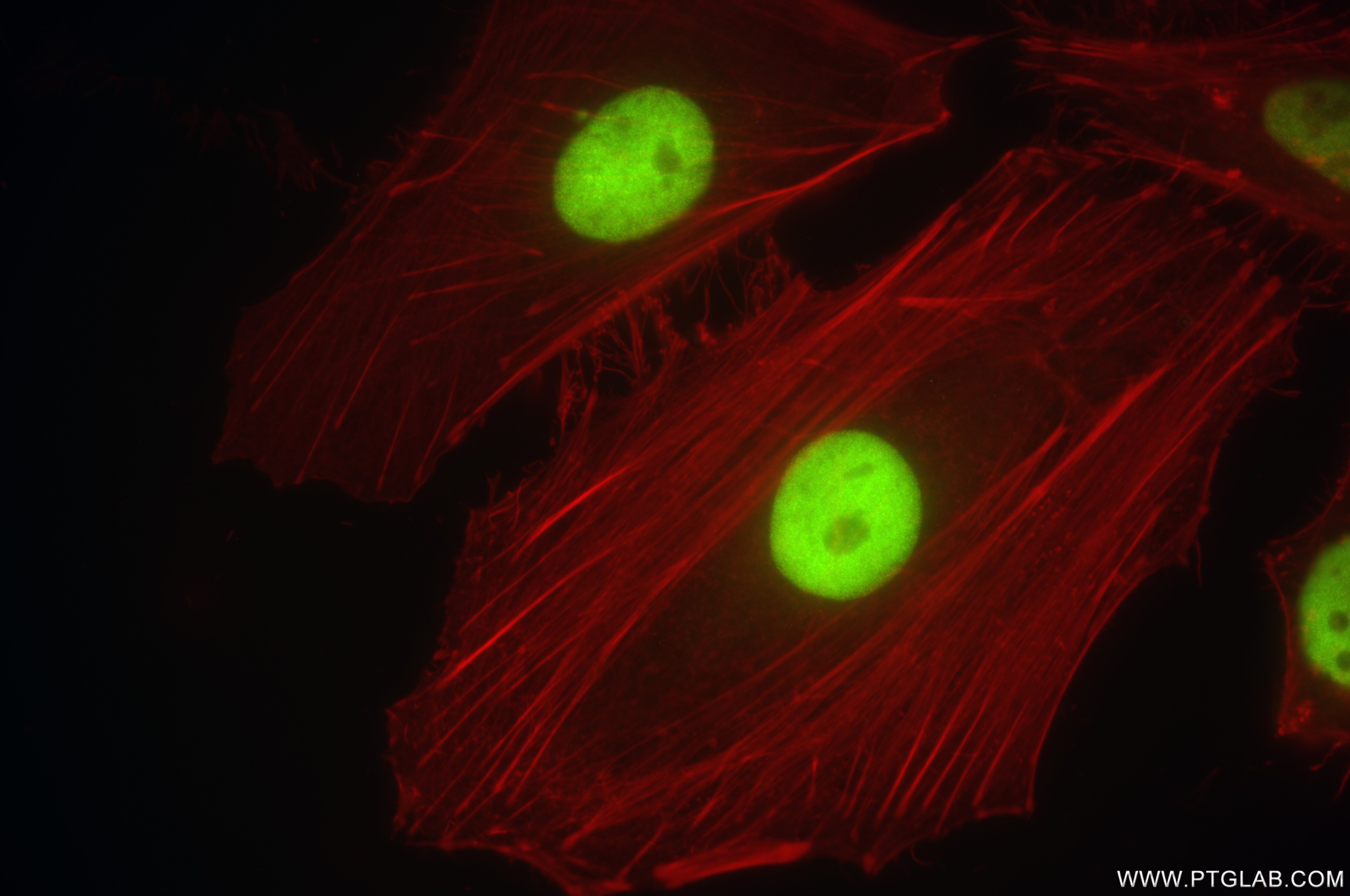 Immunofluorescence (IF) / fluorescent staining of HeLa cells using JUNB Recombinant antibody (84922-6-RR)