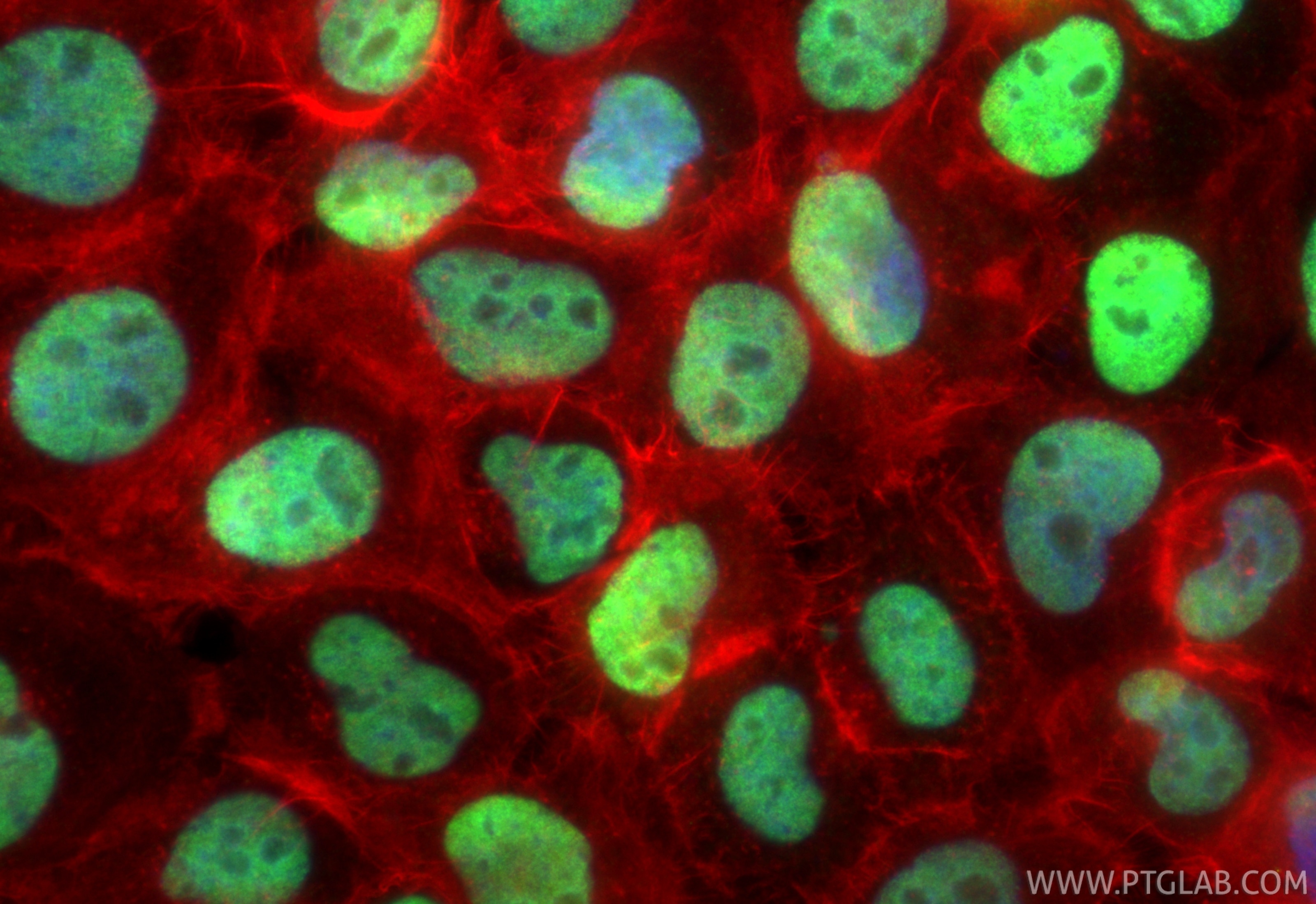 Immunofluorescence (IF) / fluorescent staining of A431 cells using JUNB Recombinant antibody (84922-6-RR)