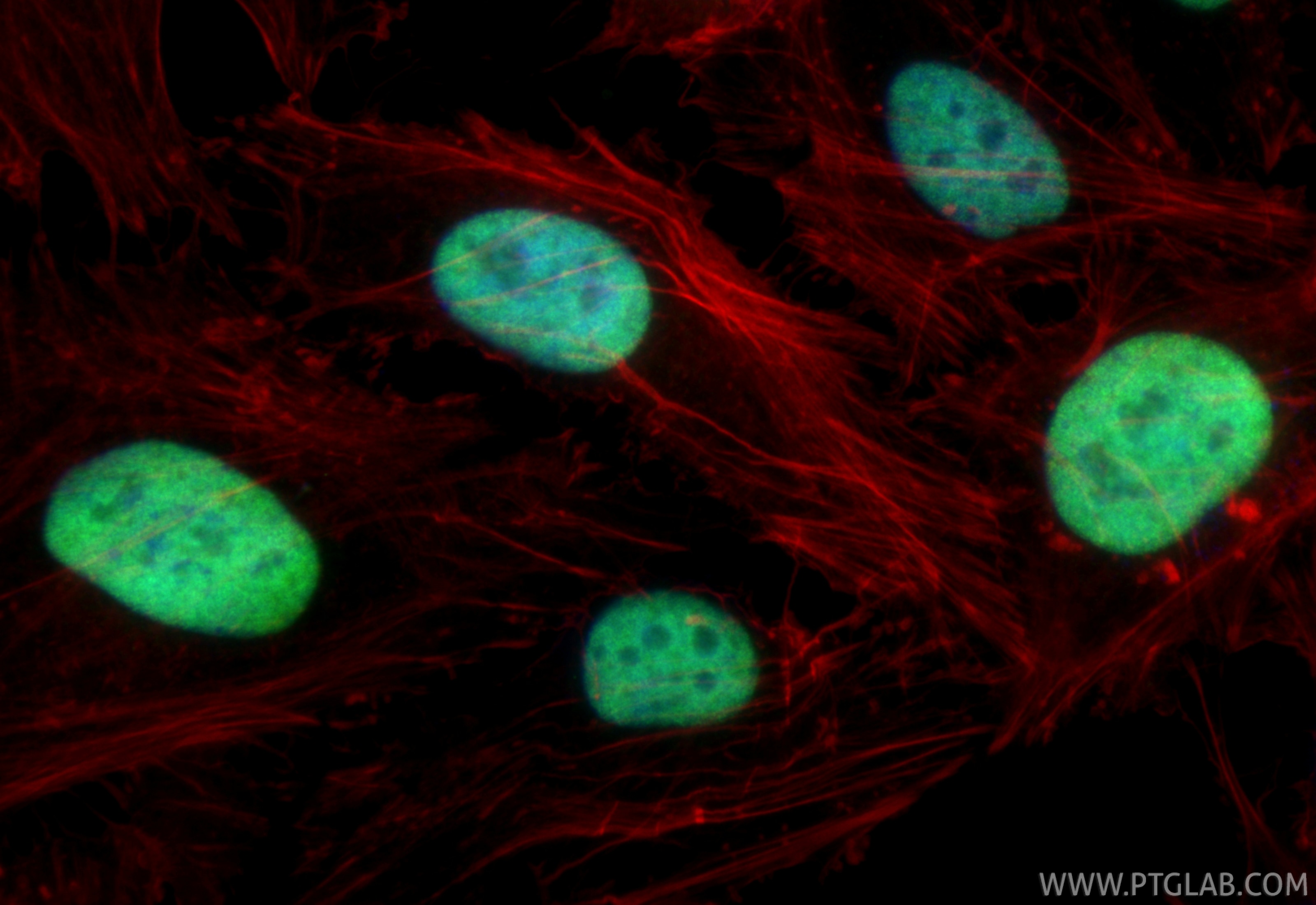 IF Staining of HeLa using RMX00032 Immunofluorescence (IF) / fluorescent staining of HeLa cells using Multi-rAb® JUNB Multi-Recombinant antibody (RMX00032)