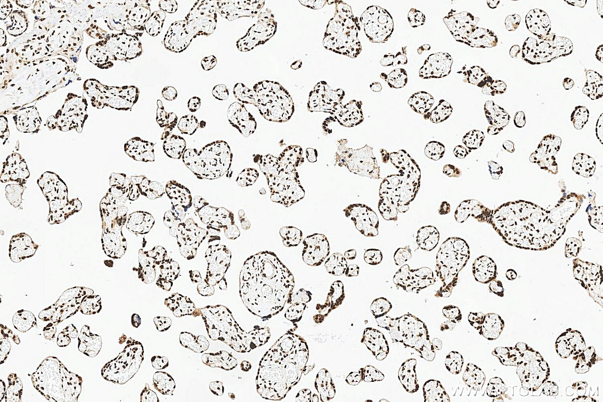 IHC staining of human placenta using 83134-6-RR Immunohistochemistry (IHC) staining of human placenta tissue using JUND Recombinant monoclonal antibody (83134-6-RR)