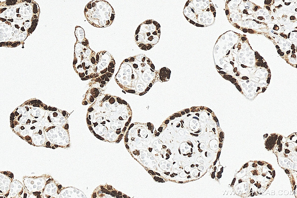 IHC staining of human placenta using 83134-6-RR Immunohistochemistry (IHC) staining of human placenta tissue using JUND Recombinant monoclonal antibody (83134-6-RR)