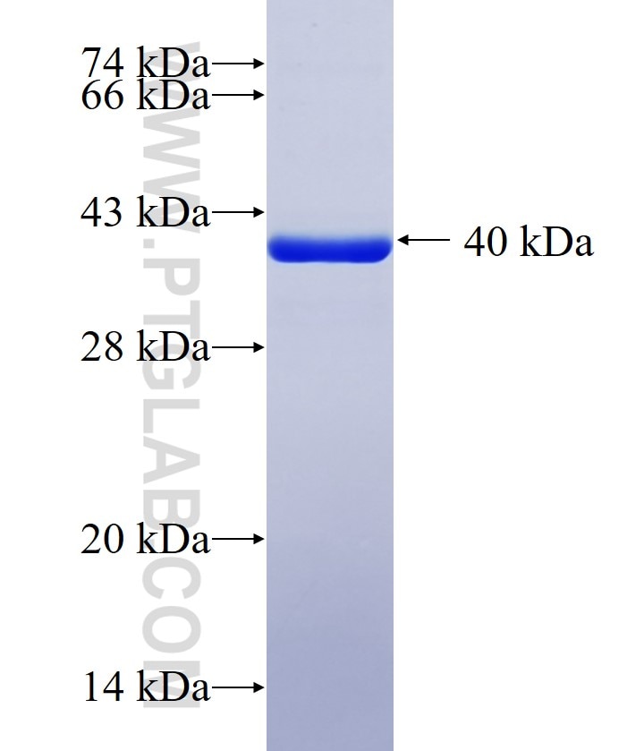 JUND fusion protein Ag29461 SDS-PAGE JUND fusion protein Ag29461 SDS-PAGE