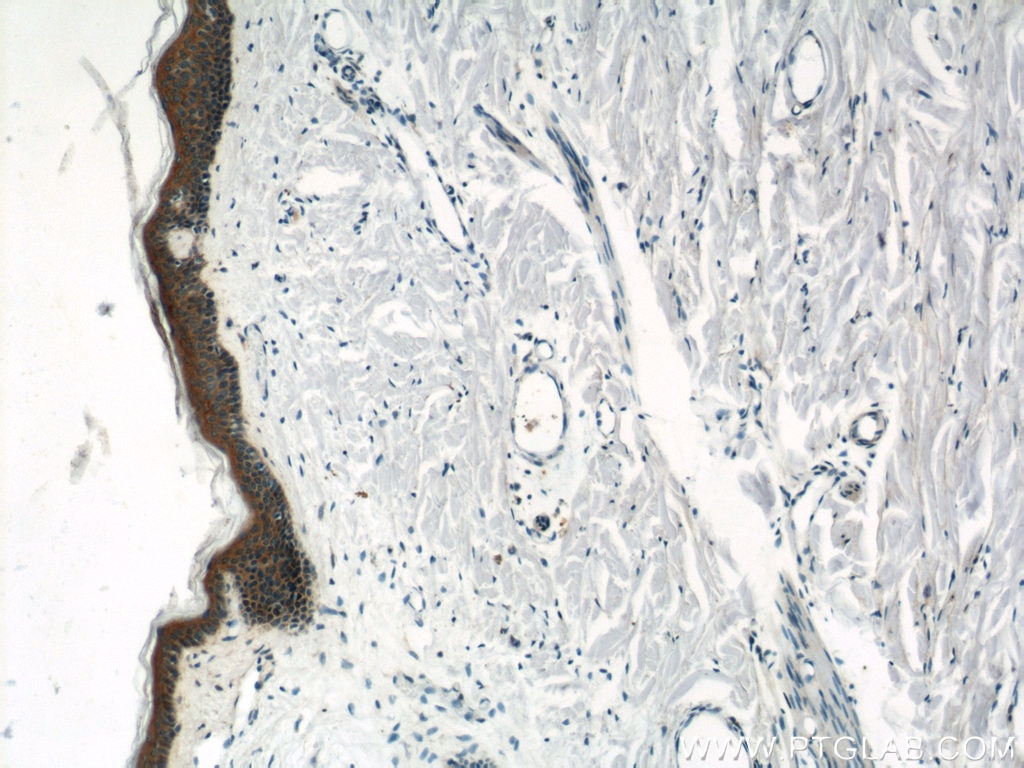 Immunohistochemistry (IHC) staining of human skin tissue using Gamma Catenin Polyclonal antibody (11146-1-AP)