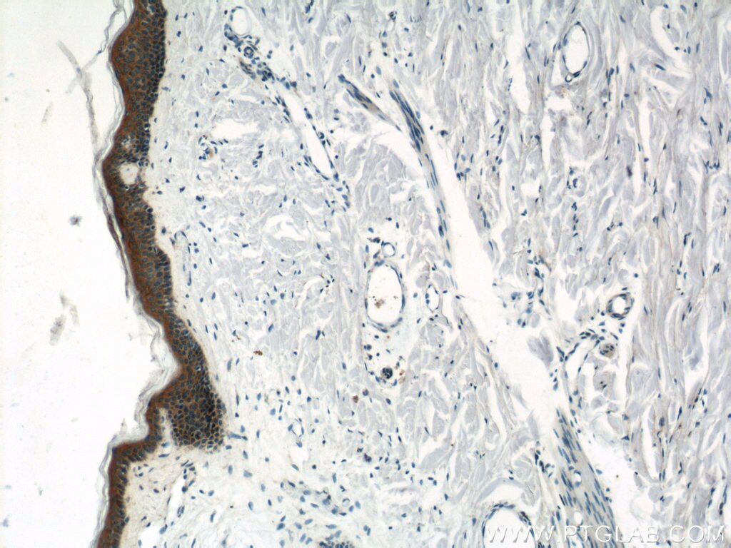 IHC staining of human skin using 11146-1-AP