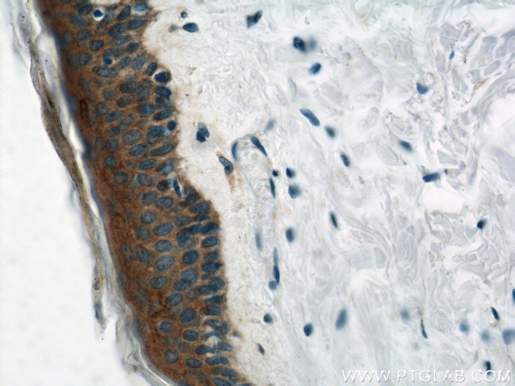 IHC staining of human skin using 11146-1-AP