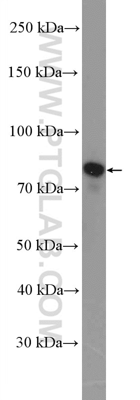 Western Blot (WB) analysis of A431 cells using Gamma Catenin Polyclonal antibody (11146-1-AP)