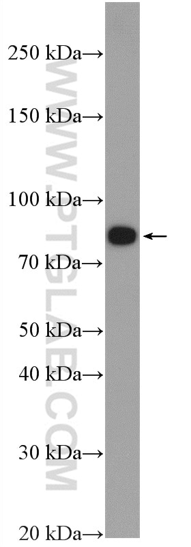 Western Blot (WB) analysis of T-47D cells using Gamma Catenin Polyclonal antibody (11146-1-AP)