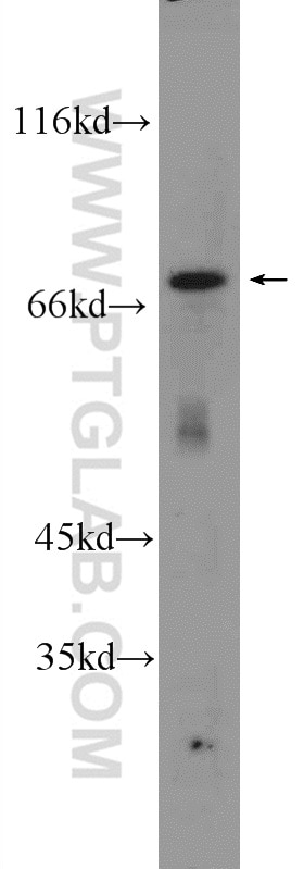 Gamma Catenin