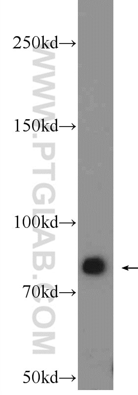 Western Blot (WB) analysis of HeLa cells using Gamma Catenin Polyclonal antibody (11146-1-AP)