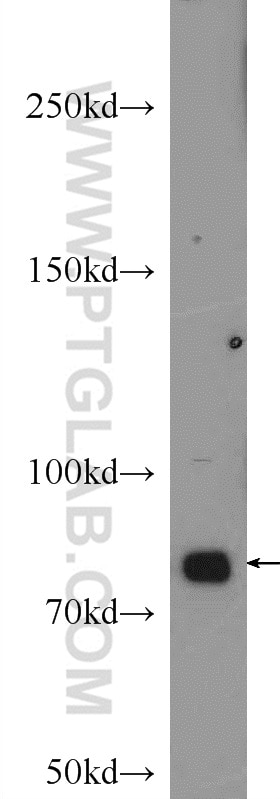 Western Blot (WB) analysis of mouse heart tissue using Gamma Catenin Polyclonal antibody (11146-1-AP)