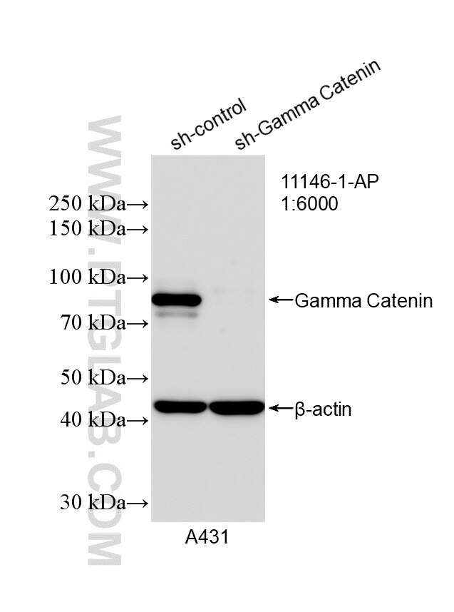 Western Blot (WB) analysis of A431 cells using Gamma Catenin Polyclonal antibody (11146-1-AP)