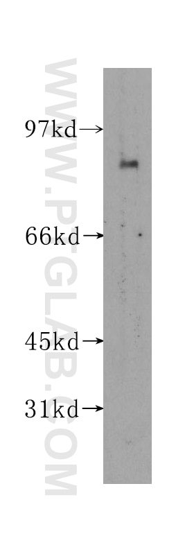 Western Blot (WB) analysis of human heart tissue using Gamma Catenin Polyclonal antibody (11146-1-AP)