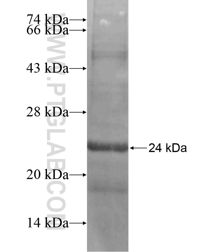 JUP fusion protein Ag17598 SDS-PAGE