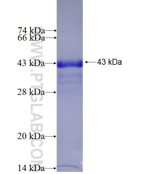 JUP fusion protein Ag27394 SDS-PAGE