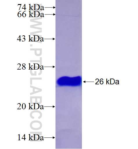 JUP fusion protein Ag27422 SDS-PAGE