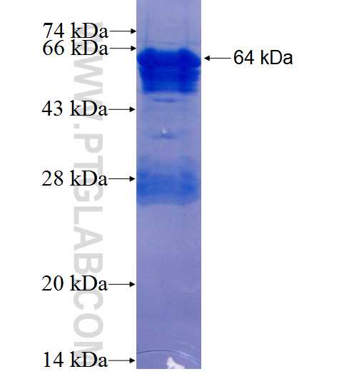 JUP fusion protein Ag1627 SDS-PAGE