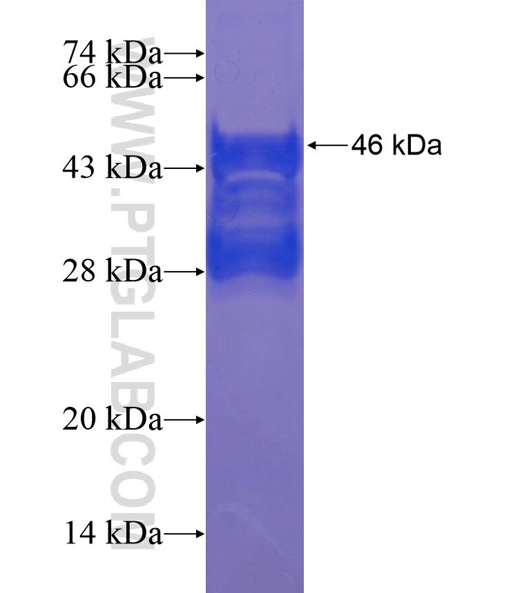 JUP fusion protein Ag17560 SDS-PAGE