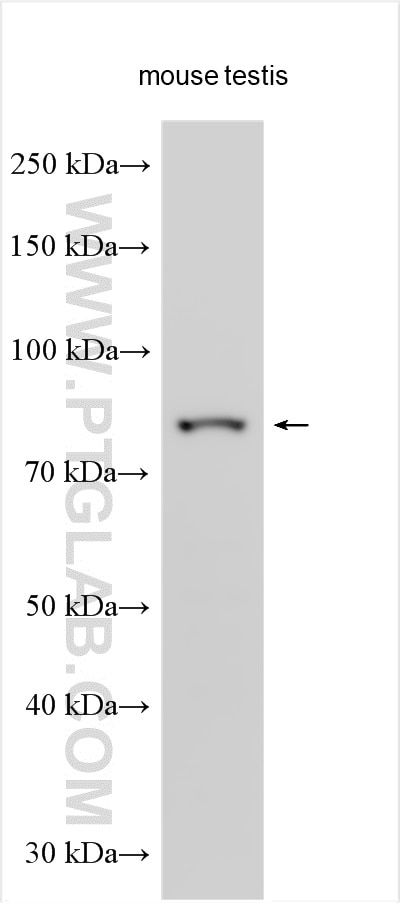 Western Blot (WB) analysis of various lysates using KAL1 Polyclonal antibody (26504-1-AP)