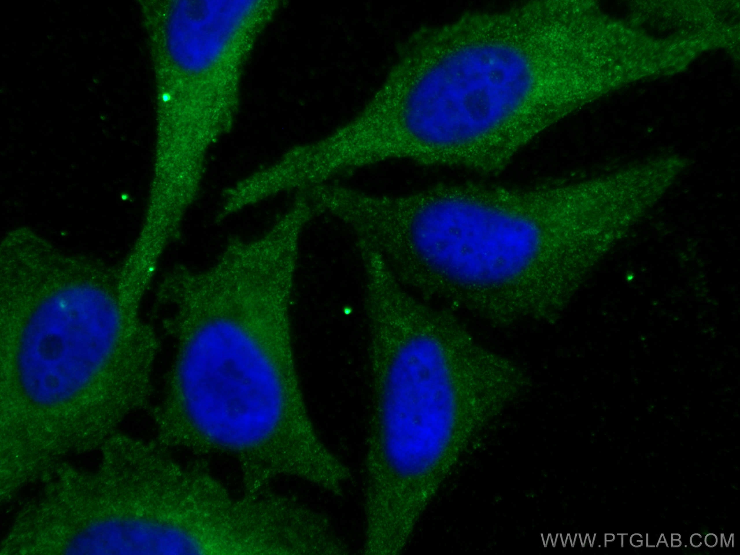 Immunofluorescence (IF) / fluorescent staining of HeLa cells using KALRN Polyclonal antibody (19740-1-AP)
