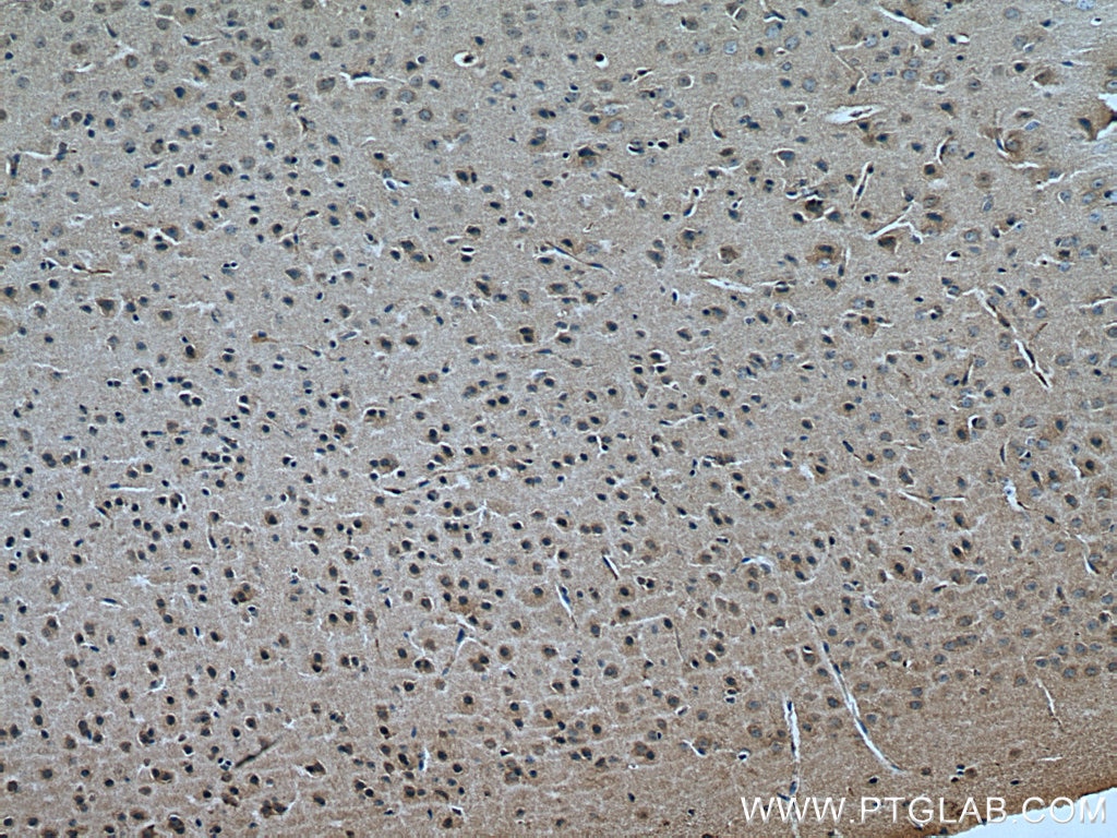 Immunohistochemistry (IHC) staining of mouse brain tissue using KALRN Polyclonal antibody (19740-1-AP)