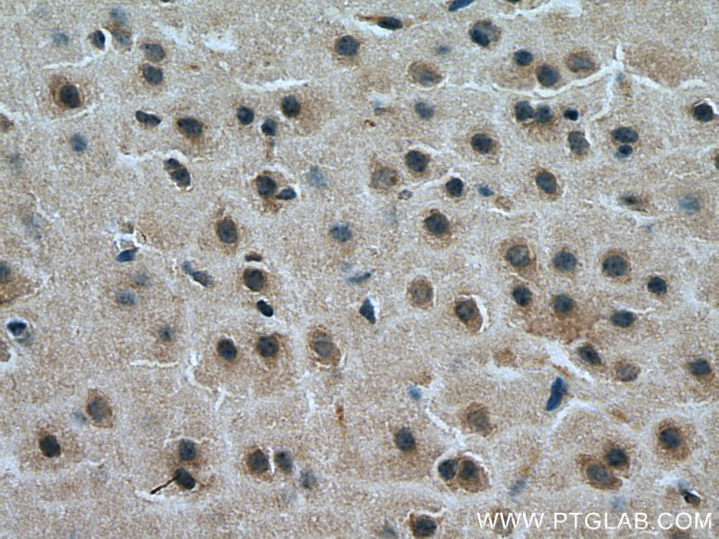 Immunohistochemistry (IHC) staining of mouse brain tissue using KALRN Polyclonal antibody (19740-1-AP)