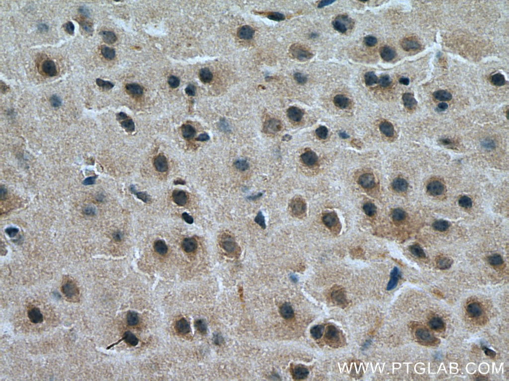 IHC staining of mouse brain using 19740-1-AP