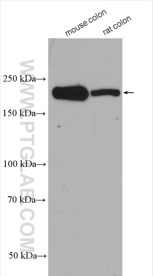 Western Blot (WB) analysis of various lysates using KALRN Polyclonal antibody (19740-1-AP)