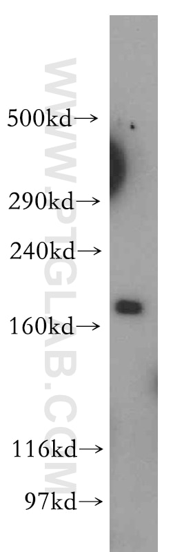 Western Blot (WB) analysis of human brain tissue using KALRN Polyclonal antibody (19740-1-AP)