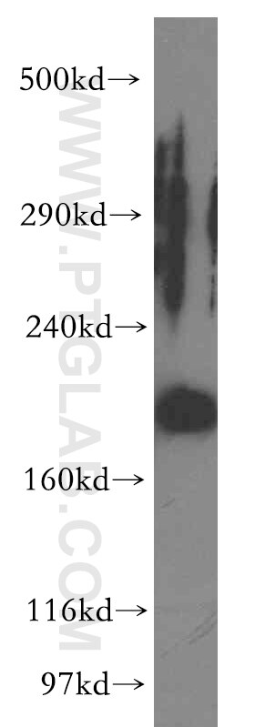 Western Blot (WB) analysis of human kidney tissue using KALRN Polyclonal antibody (19740-1-AP)