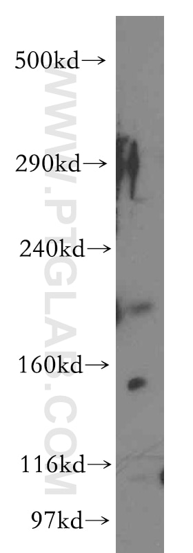 Western Blot (WB) analysis of human kidney tissue using KALRN Polyclonal antibody (19740-1-AP)