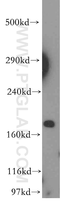 Western Blot (WB) analysis of human brain tissue using KALRN Polyclonal antibody (19740-1-AP)