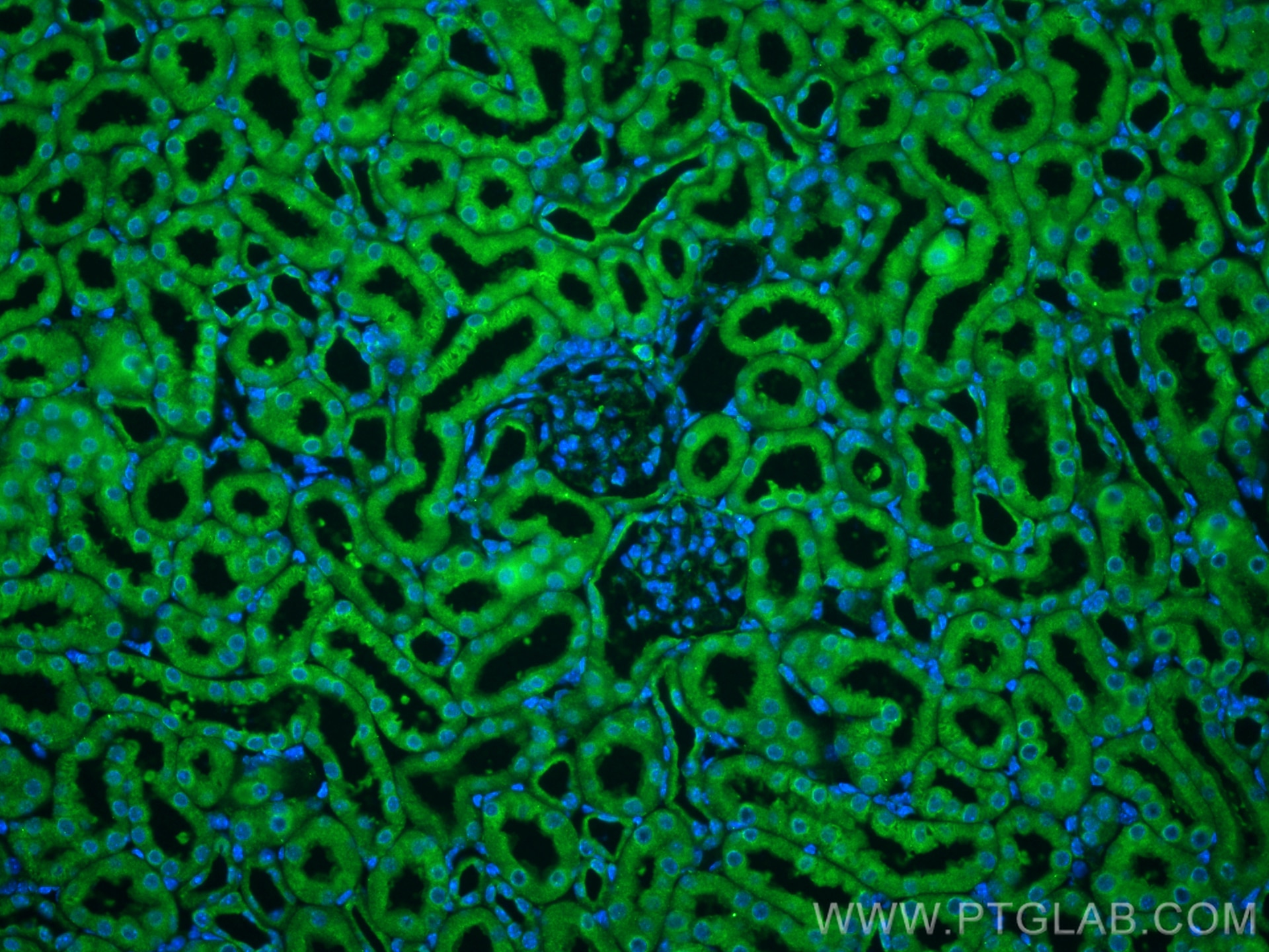 Immunofluorescence (IF) / fluorescent staining of mouse kidney tissue using KANK1 Polyclonal antibody (29782-1-AP)