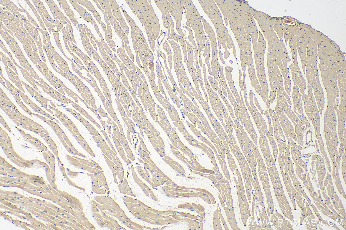 Immunohistochemistry (IHC) staining of mouse heart tissue using KANK1 Polyclonal antibody (29782-1-AP)