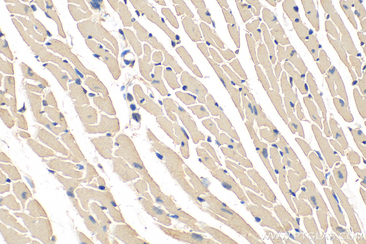 Immunohistochemistry (IHC) staining of mouse heart tissue using KANK1 Polyclonal antibody (29782-1-AP)