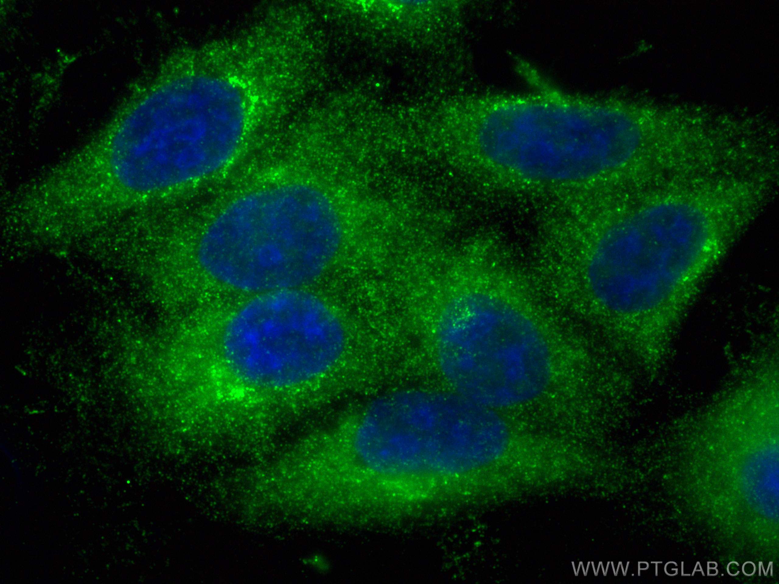 Immunofluorescence (IF) / fluorescent staining of HepG2 cells using KANK1 Monoclonal antibody (68613-1-Ig)