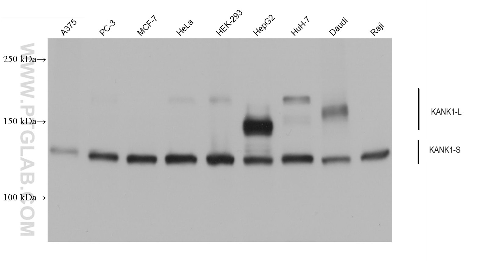 Western Blot (WB) analysis of various lysates using KANK1 Monoclonal antibody (68613-1-Ig)