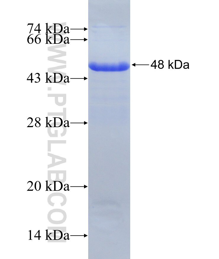 KANK1 fusion protein Ag31422 SDS-PAGE