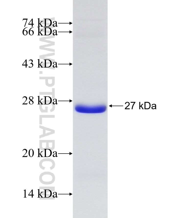 KANK1 fusion protein Ag31440 SDS-PAGE