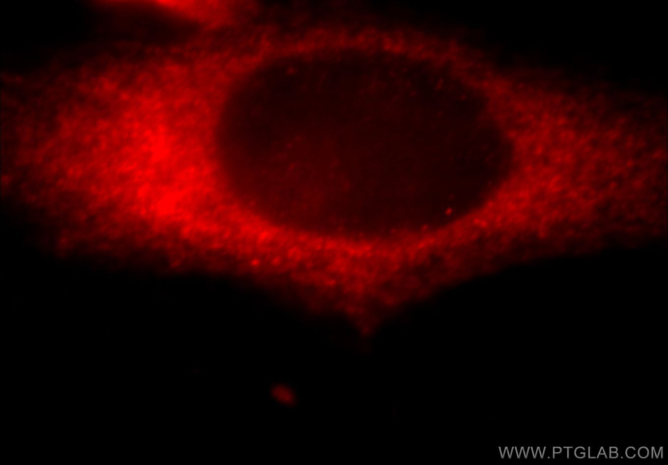 Immunofluorescence (IF) / fluorescent staining of HeLa cells using KANK2 Polyclonal antibody (20546-1-AP)