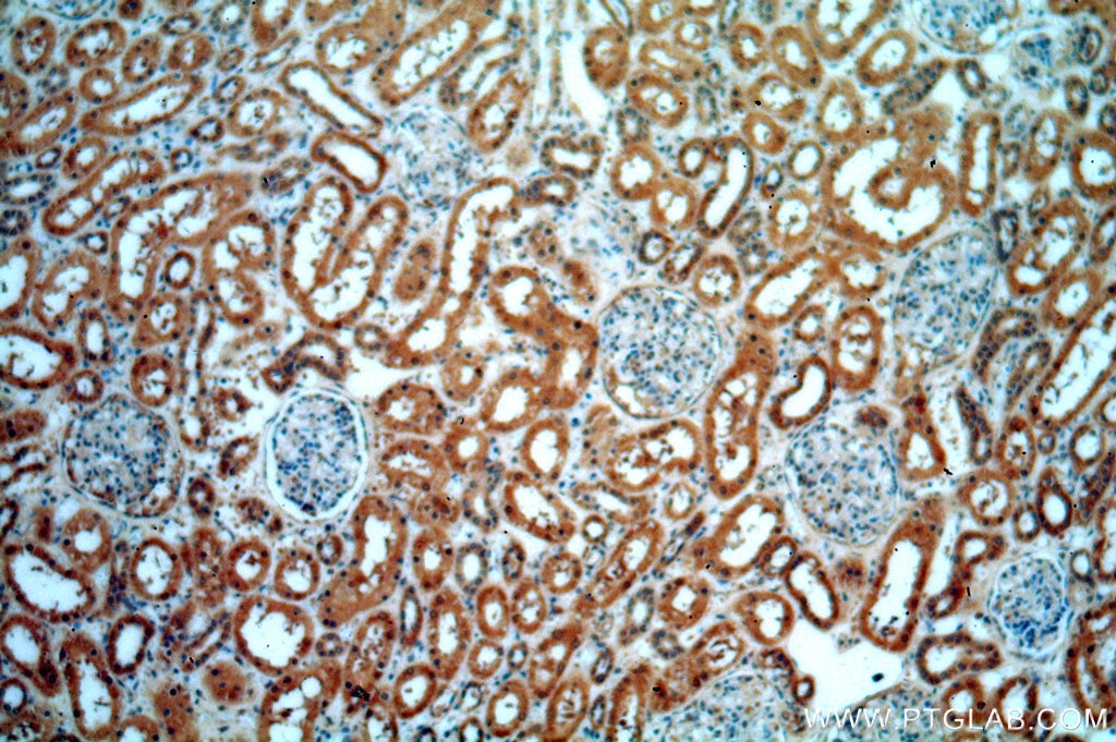 Immunohistochemistry (IHC) staining of human kidney tissue using KANK2 Polyclonal antibody (20546-1-AP)