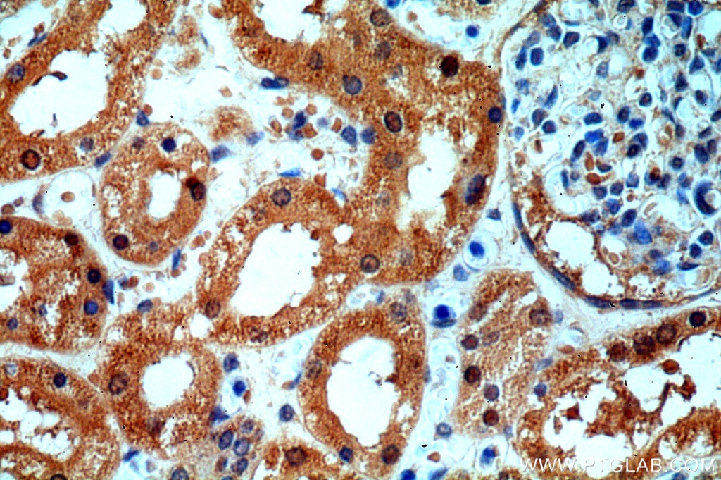 Immunohistochemistry (IHC) staining of human kidney tissue using KANK2 Polyclonal antibody (20546-1-AP)