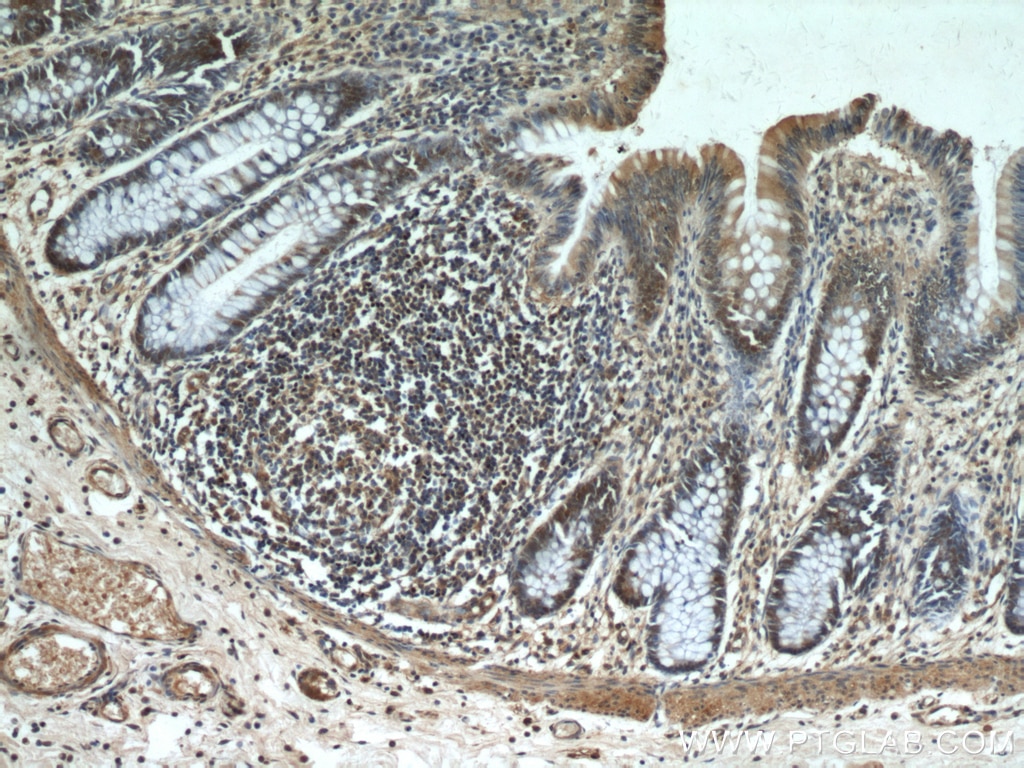 Immunohistochemistry (IHC) staining of human colon tissue using KANK2 Polyclonal antibody (20546-1-AP)