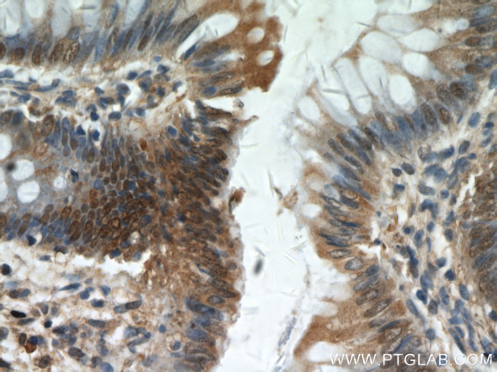 Immunohistochemistry (IHC) staining of human colon tissue using KANK2 Polyclonal antibody (20546-1-AP)