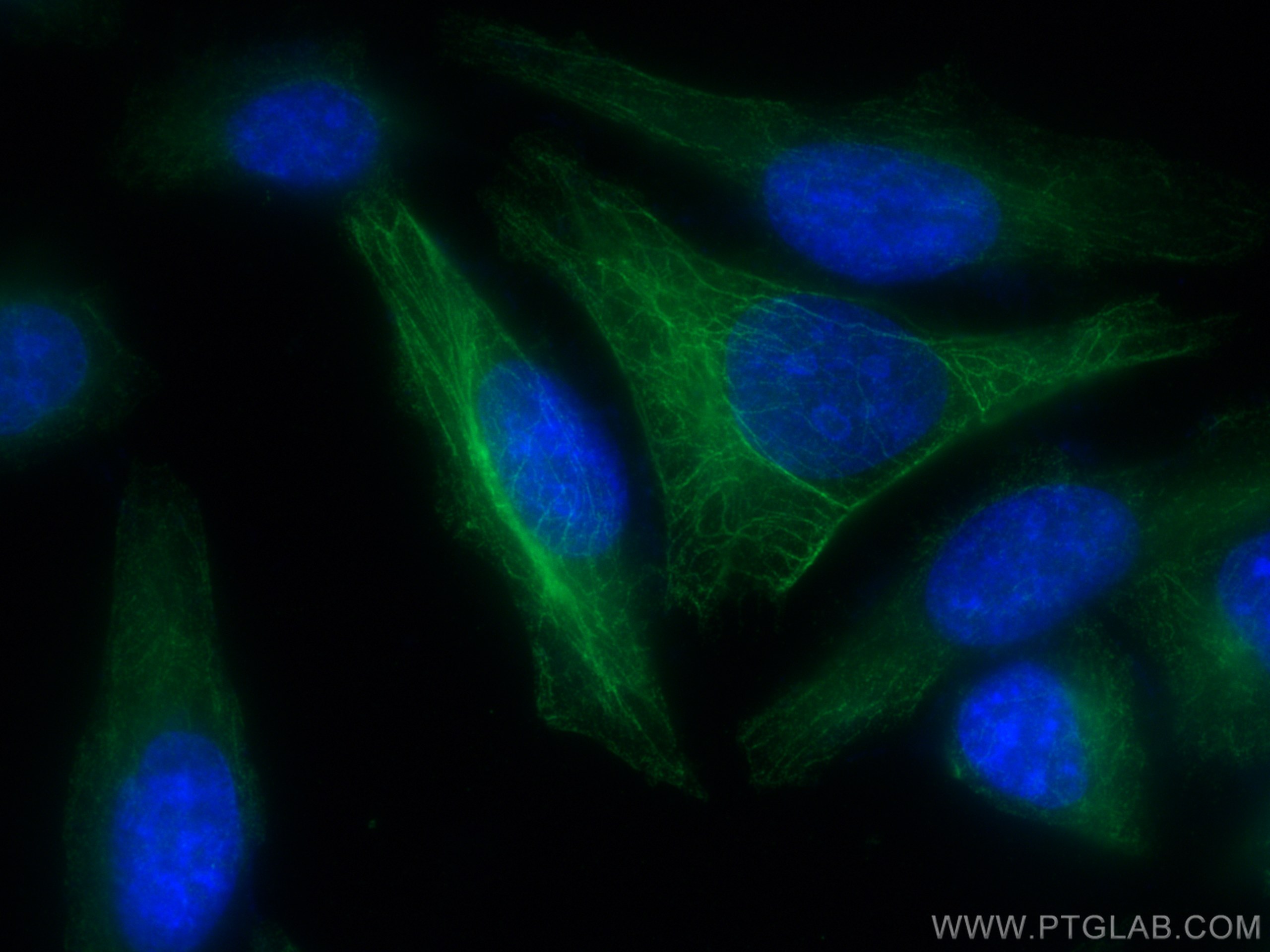 Immunofluorescence (IF) / fluorescent staining of HepG2 cells using KANK2 Polyclonal antibody (21733-1-AP)