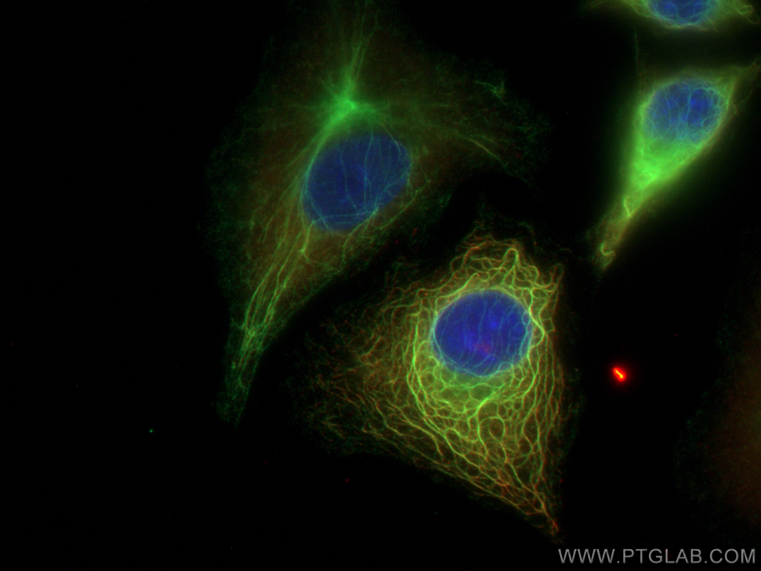 Immunofluorescence (IF) / fluorescent staining of A549 cells using KANK2 Polyclonal antibody (21733-1-AP)