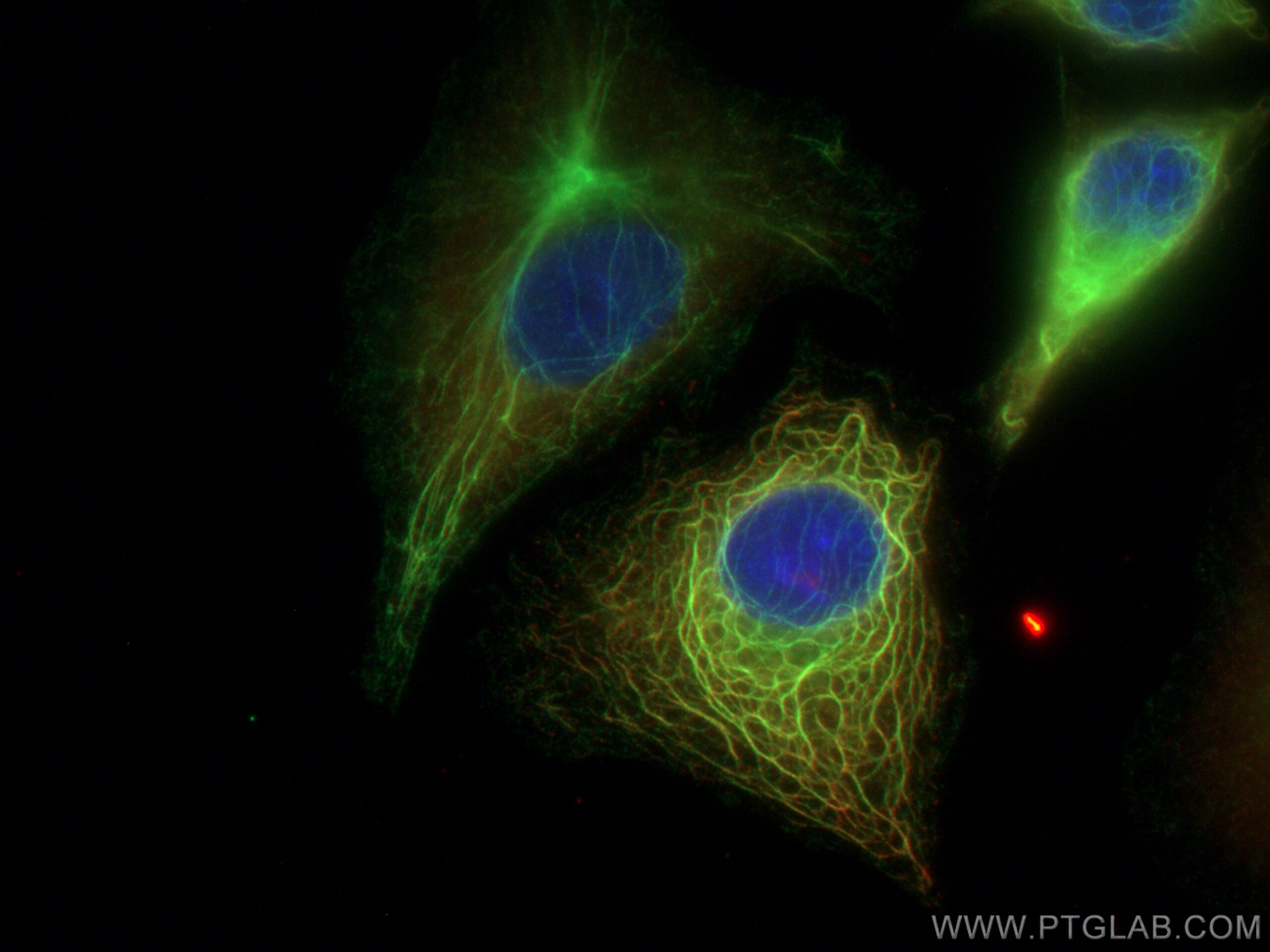 IF Staining of A549 using 21733-1-AP