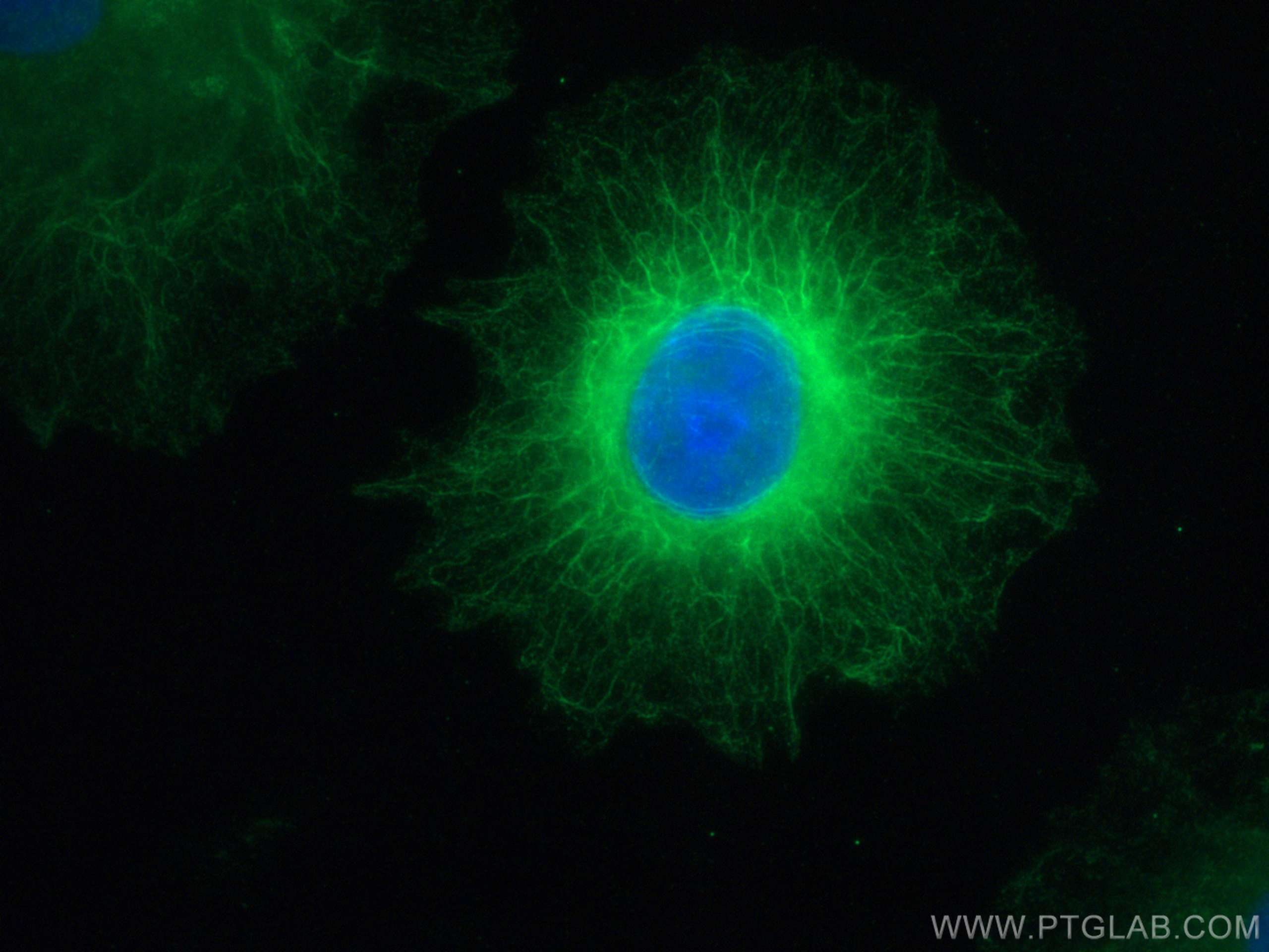 Immunofluorescence (IF) / fluorescent staining of A549 cells using KANK2 Polyclonal antibody (21733-1-AP)