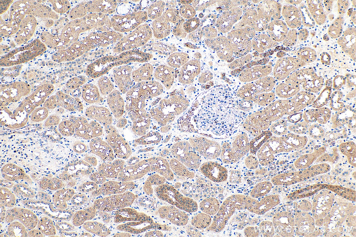 Immunohistochemistry (IHC) staining of human kidney tissue using KANK2 Polyclonal antibody (21733-1-AP)